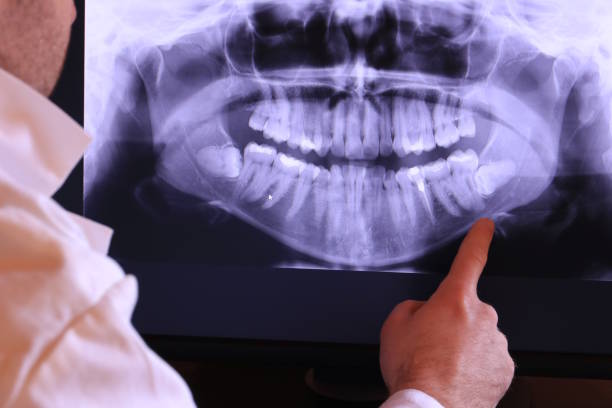 Best Urgent Dental Care for Toothaches in Laurel Bay, SC