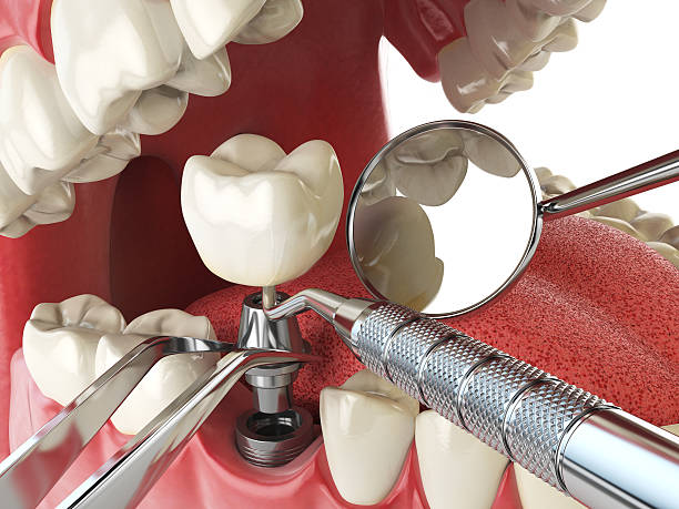 Best Walk-In Emergency Dental Services in Laurel Bay, SC