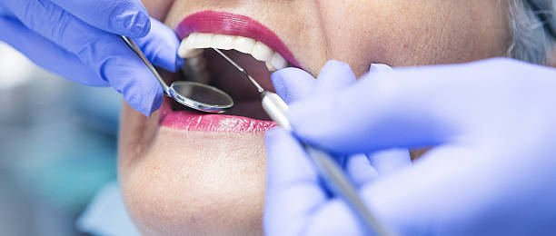Best Dental Abscess Treatment in Laurel Bay, SC